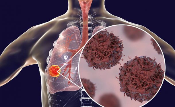 Pulmonary Function Test